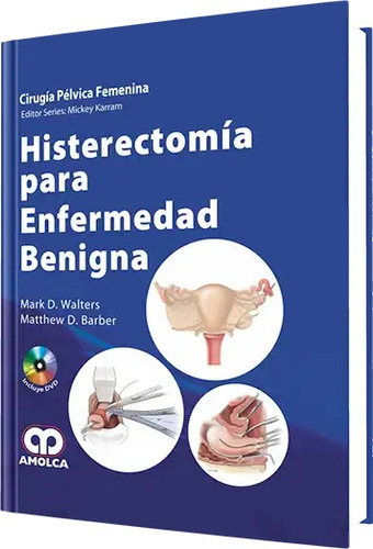 Histerectomía Para Enfermedad Benigna