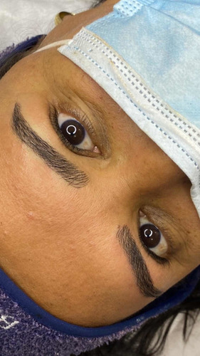 Imagem 5 de 5 de Micropigmentação E Estética