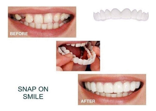 Br 1 Par De Dentes Cosméticos Temporary Smile Fit Indent