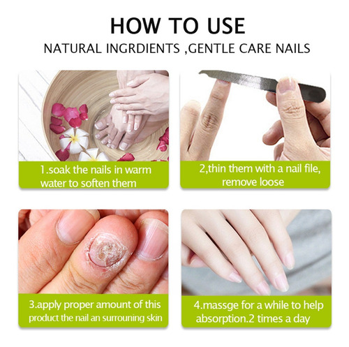 Gel Reparador De Uñas Efero, 2 Unidades, Tratamiento De Uñas
