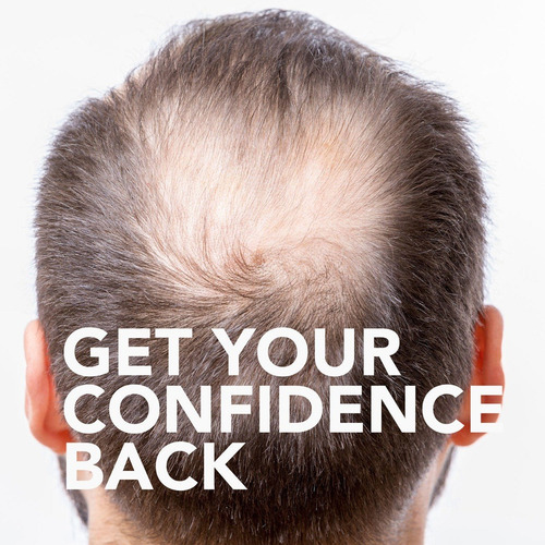 Imagen 5 de 5 de Member's Mark Minoxidil 5% Solución Tópica 6 Meses * Krklnd