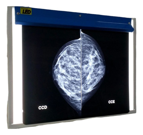Negatoscopio Led Para Mamografia Digital , Rx E Odonto.