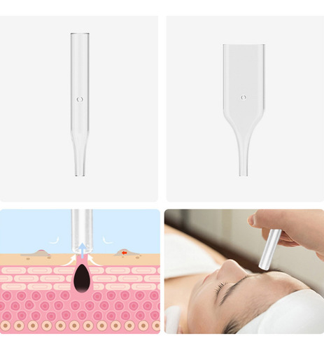 Dispositivo De Dermoabrasión Con Microtallado De Diamante 3
