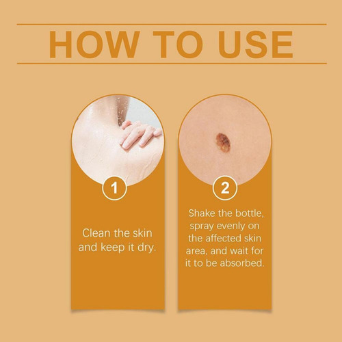 - Tratamiento For Eliminar Verrugas Y Botones En Aerosol Tag