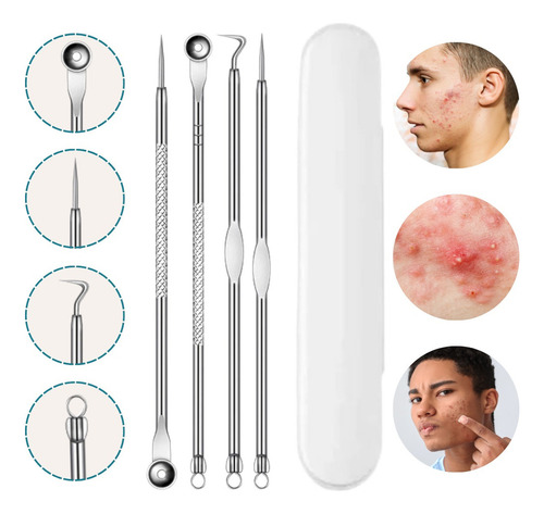 Kit Removedor Extractor Puntos Negros Espinillas Acne 4 Pzs
