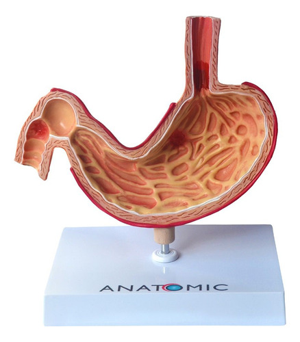 Estômago Humano Com Patologias, Anatomia