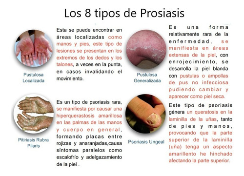 Nopsor Jab Sol, Más Suave, Pepepsor, Shampo Aux Tx Psoriasis