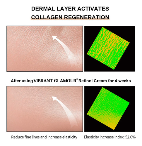 O Creme De Olhos P Retinol Remove Olheiras E Reduz A Fina L