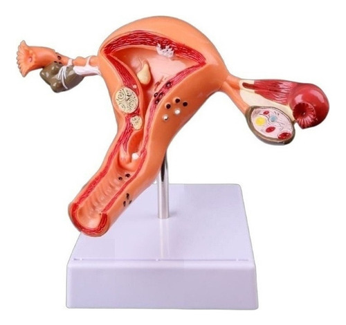 Modelo De Anatomía Del Ovario Reproductor Femenino.