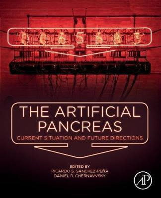 Libro The Artificial Pancreas : Current Situation And Fut...