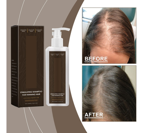Shampoo Loss Shampoo Para Homens 100ml
