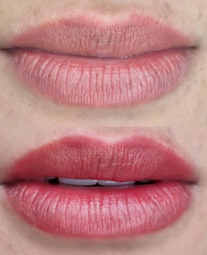 Imagen 4 de 4 de Micropigmentacion Labial