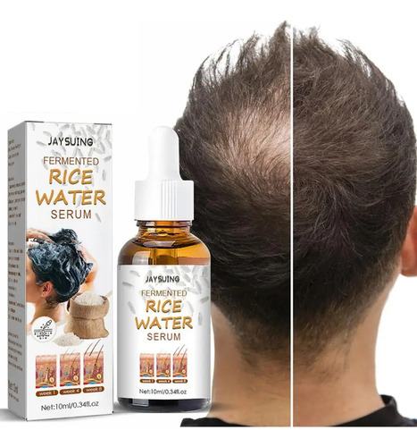Serum Rice Para Crecimiento De Cabello Antiestres Anticaida