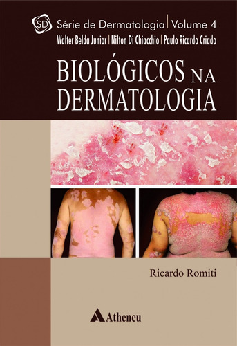 Biológicos na dermatologia, de Belda Junior, Walter. Série Série de Dermatologia Editora Atheneu Ltda, capa dura em português, 2017