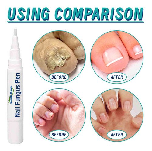 Canetas Reparadoras De Unhas E Unhas Dos Pés Para Melhorar A