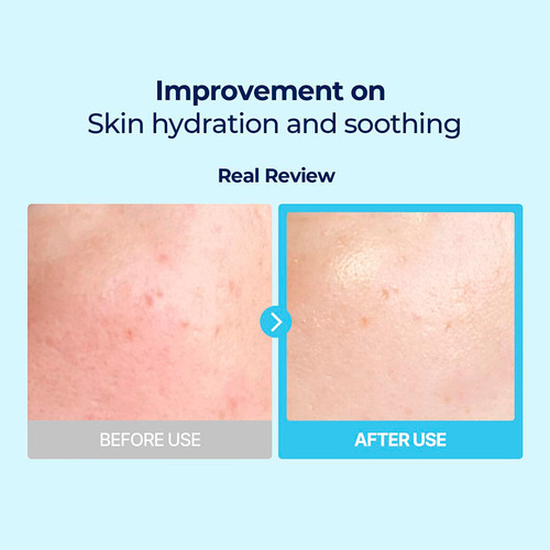 Toner Pad Con Ácido Hialurónico Torriden Cosmética Coreana