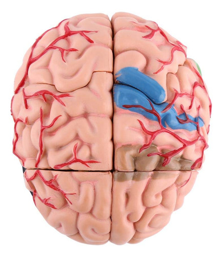 Modelo De Cerebro Humano Desmontable Con Base