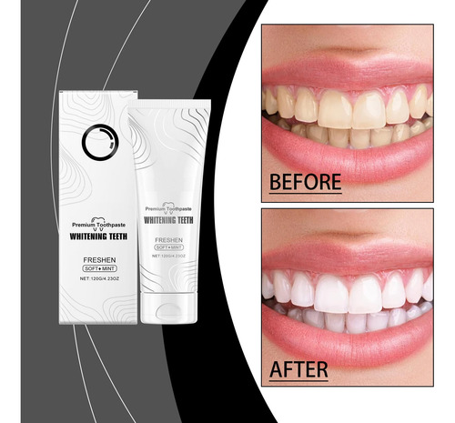Pasta De Dientes Con Hidroxiapatita Para Limpiar Los Dientes