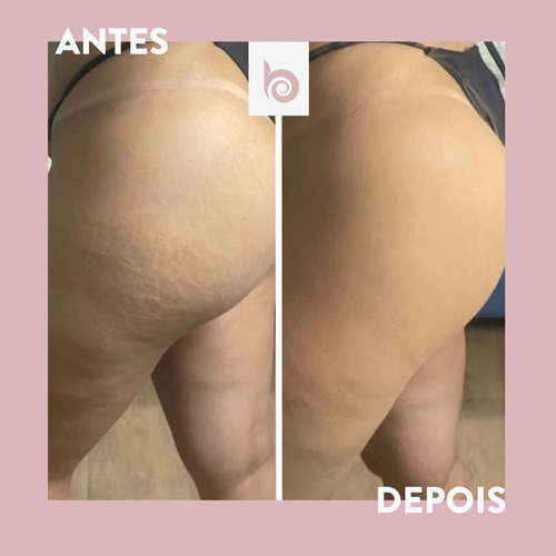 Best Bronze Maquillaje Para Cuerpo Y Piernas (color Medio)