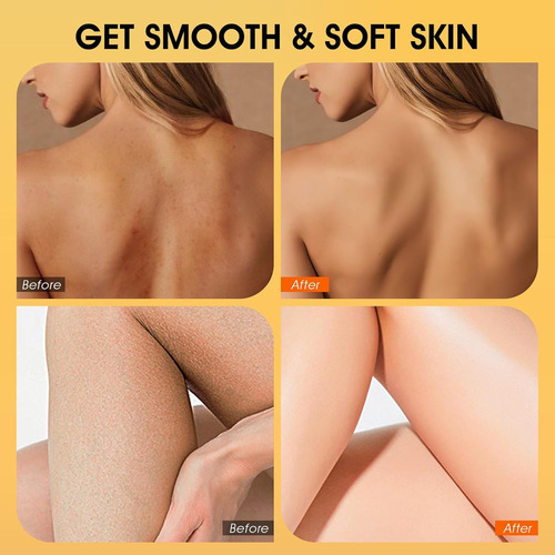 Exfoliante Corporal, Exfoliante Corporal De Cúrcuma, Con Ace