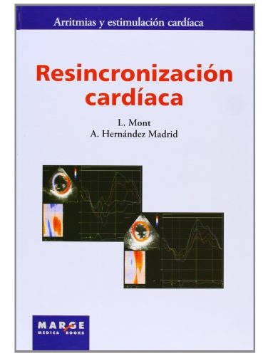 Resincronizacion Cardiaca - Mont I Girbau Josep Lluis