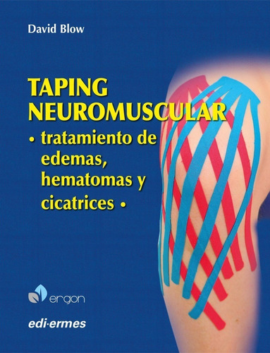 Blow Taping Neuromuscular. Edemas, Hematomas Y Cicatrices