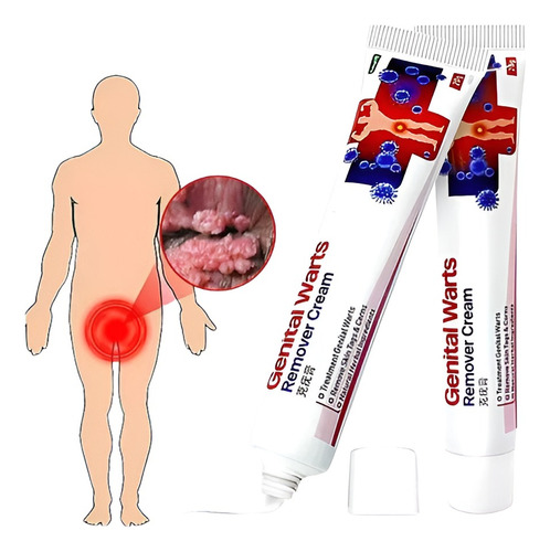 1x Pomada Contra Verruga Partes Íntimas | Hpv | Coceira