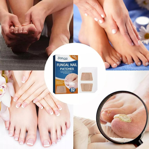 32 Parches Reparacion Uñas Nail Hongos Extracto De Hierbas