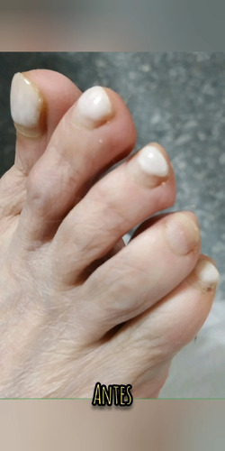 Pedicura A Domicilio