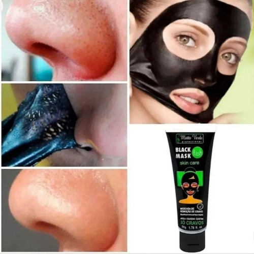Imagem 1 de 4 de Máscara Preta Removedora De Cravos Skin Care