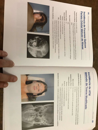 Imagem 6 de 7 de Posicionamento Em Radiologia - Editora Corpus