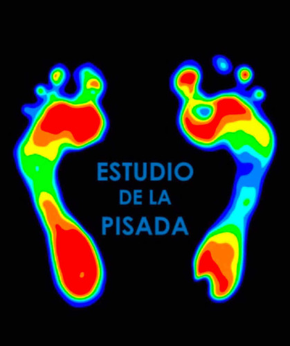 Estudio De Pisada Y Plantillas Ortopédicas