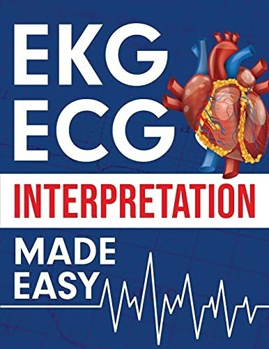 Book : Ekg | Ecg Interpretation Made Easy An Illustrated...