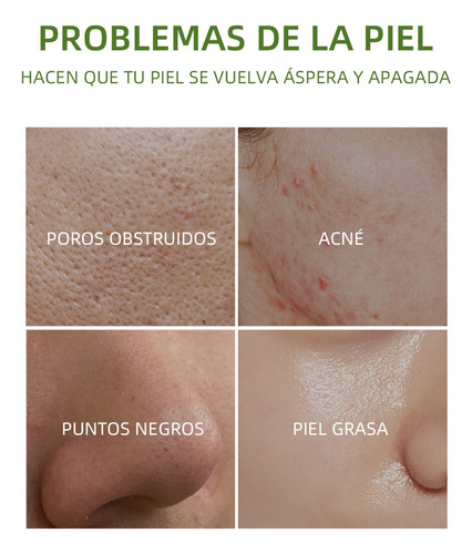 Hr Mascarilla De Té Verde Mascarilla De Barro Limpiadora