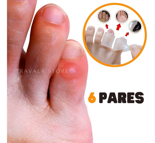 Imagem 3 de 9 de Protetor Anti Bolhas Nos Dedos Dos Pés Kit 6 Pares Anticalo