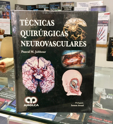 Técnicas Quirúrgicas Neurovasculares