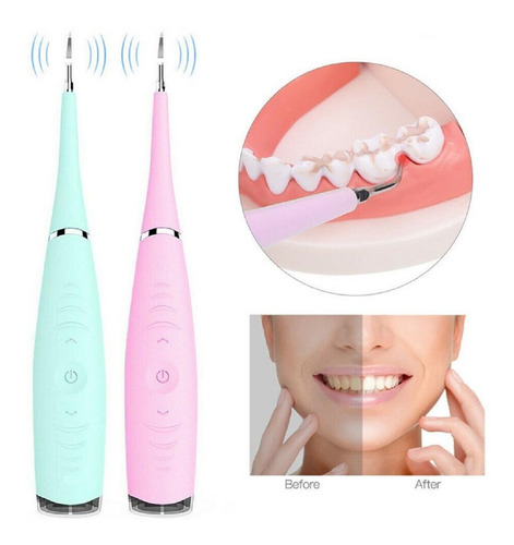 Removedor Dental Ultrasonico Portátil Usb Cálculos
