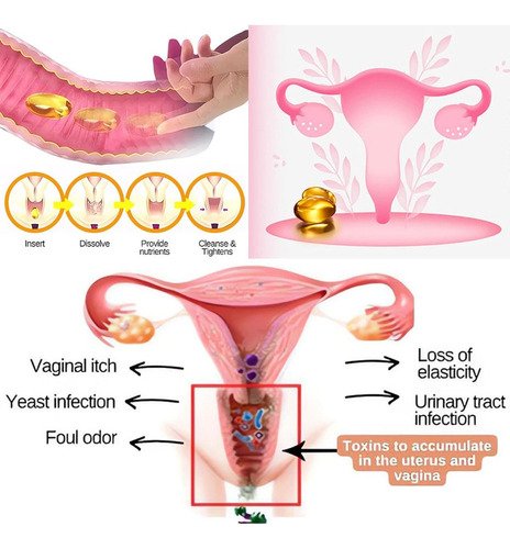 - Cápsula De Reparación Vaginal Natural Femipure 3 Botellas