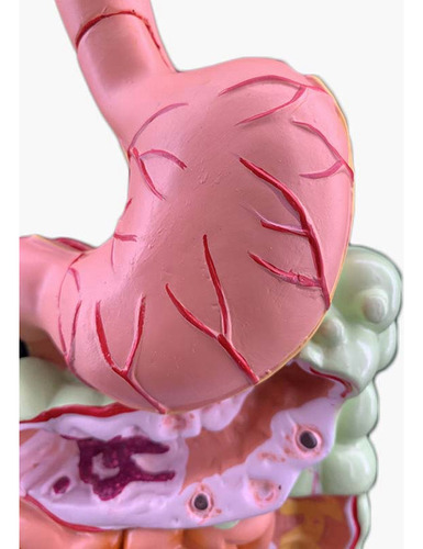 Modelo Do Sistema Digestivo Humano Anatomia Do Estômago Inte