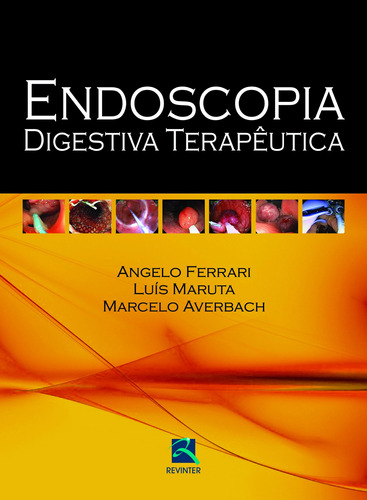 Endoscopia Digestiva Terapêutica, de Ferrari, Angelo. Editora Thieme Revinter Publicações Ltda, capa dura em português, 2015