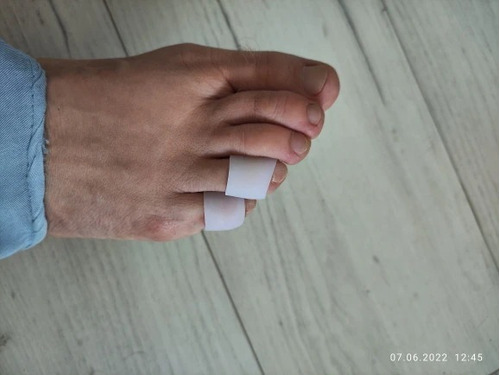 Imagem 6 de 10 de 2 Pares Separador Protetor Dedo Pé Silicone Anti Calos Bolh