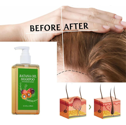 ChampĂș De Aceite De Batana, Shampoo Romero