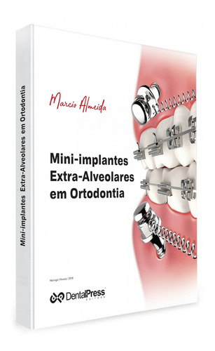 Livro Mini-implantes Extra-alveolares Em Ortodontia