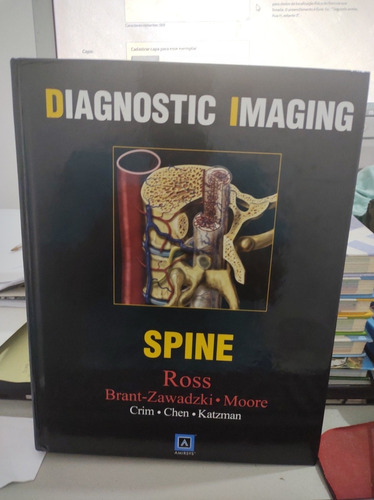 Diagnostic Imaging Spine Capa Dura Em Inglês Ross 2004