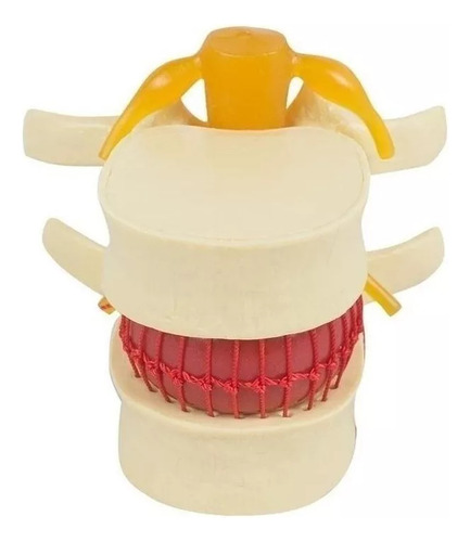 Anatomía Disco Lumbar Columna Vertebral Modelo Enseñando2024