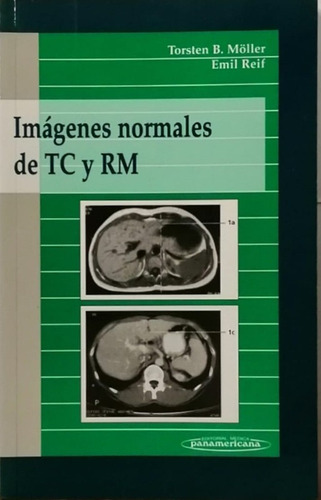 Imagenes Normales De Tc Y Rm - Moeller; Reif