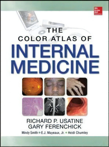 Color Atlas Of Internal Medicine, De Richard Usatine. Editorial Mcgraw-hill Education - Europe En Inglés