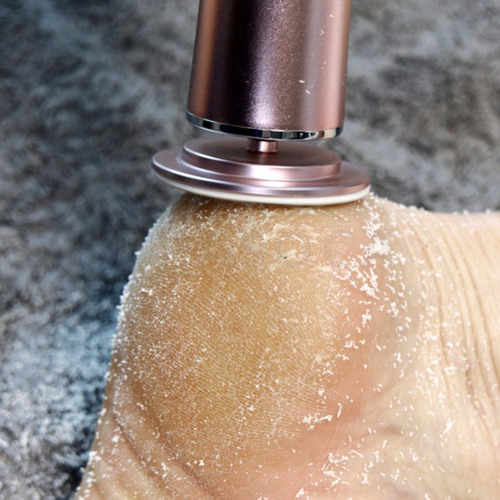 Motorzinho Lixar Calos Rachaduras Ideal A Pedicures Cabo Usb