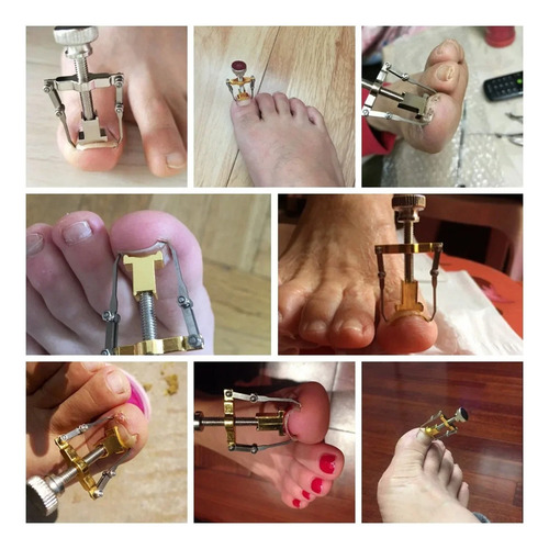 10 Pcs Herramienta Sacar Uñas Enterradas Removedor Uñeros