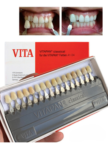 Colorimetro Dental Vita Classical Guia Colores Odontología